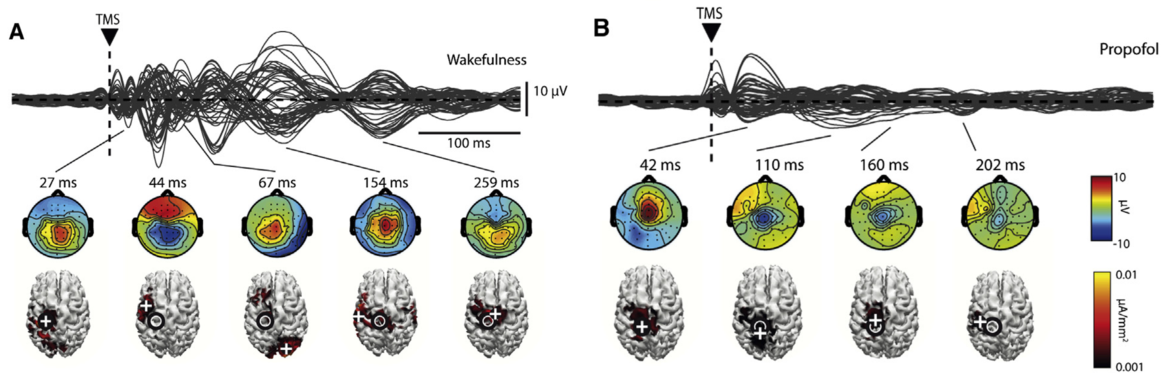 Spatiotemporal Dynamics Induced by Propofol during TMS-EEG