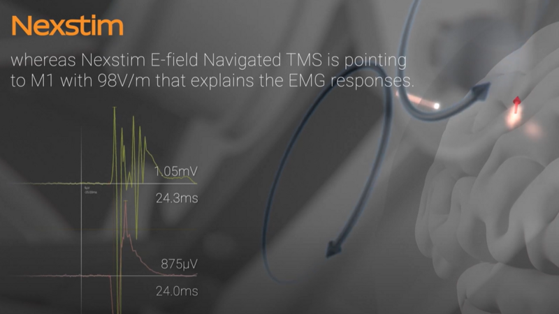 Animation about e-field