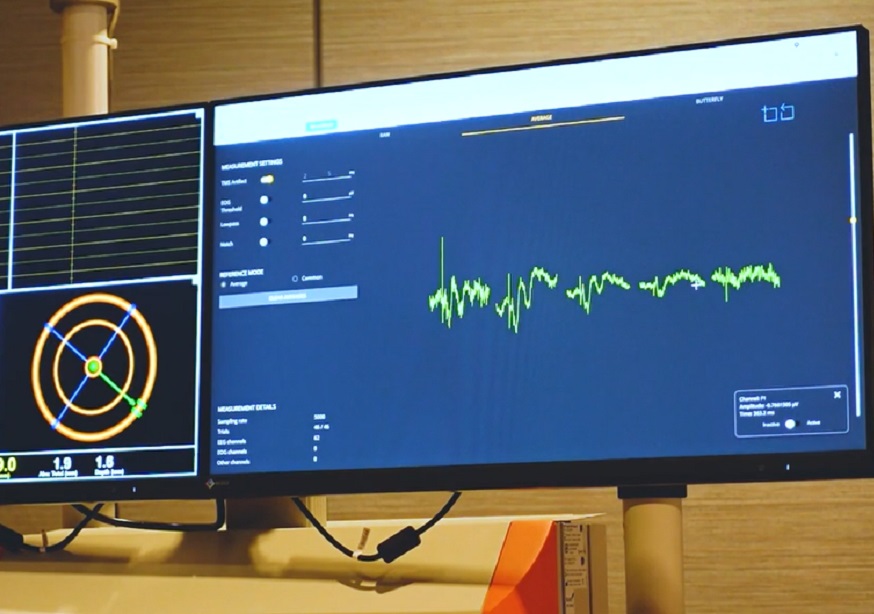 TMS-EEG-evoked potential at Brain Stimulation Conference 2021 in Charleston South Carolina.